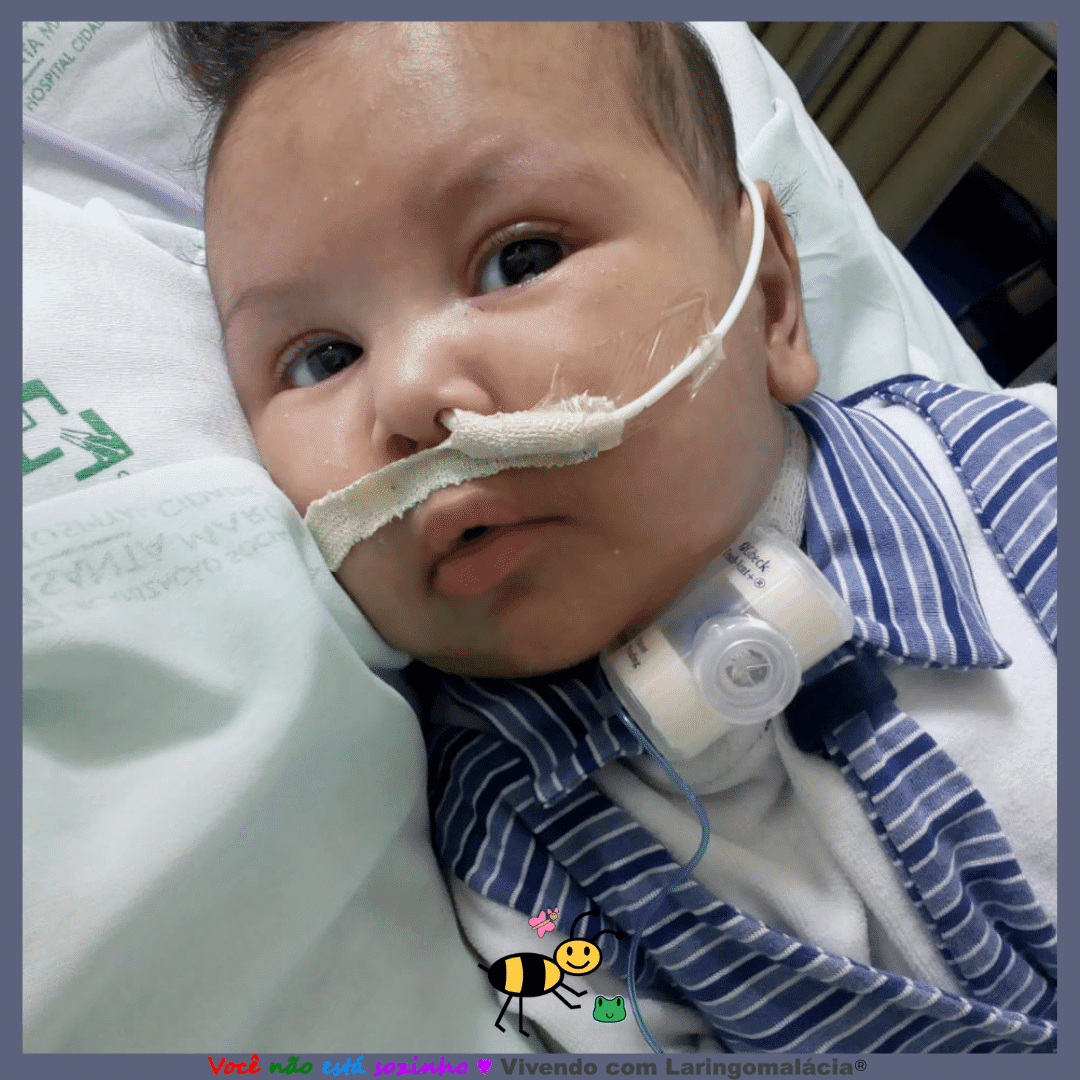Vivendo com Laringomalácia