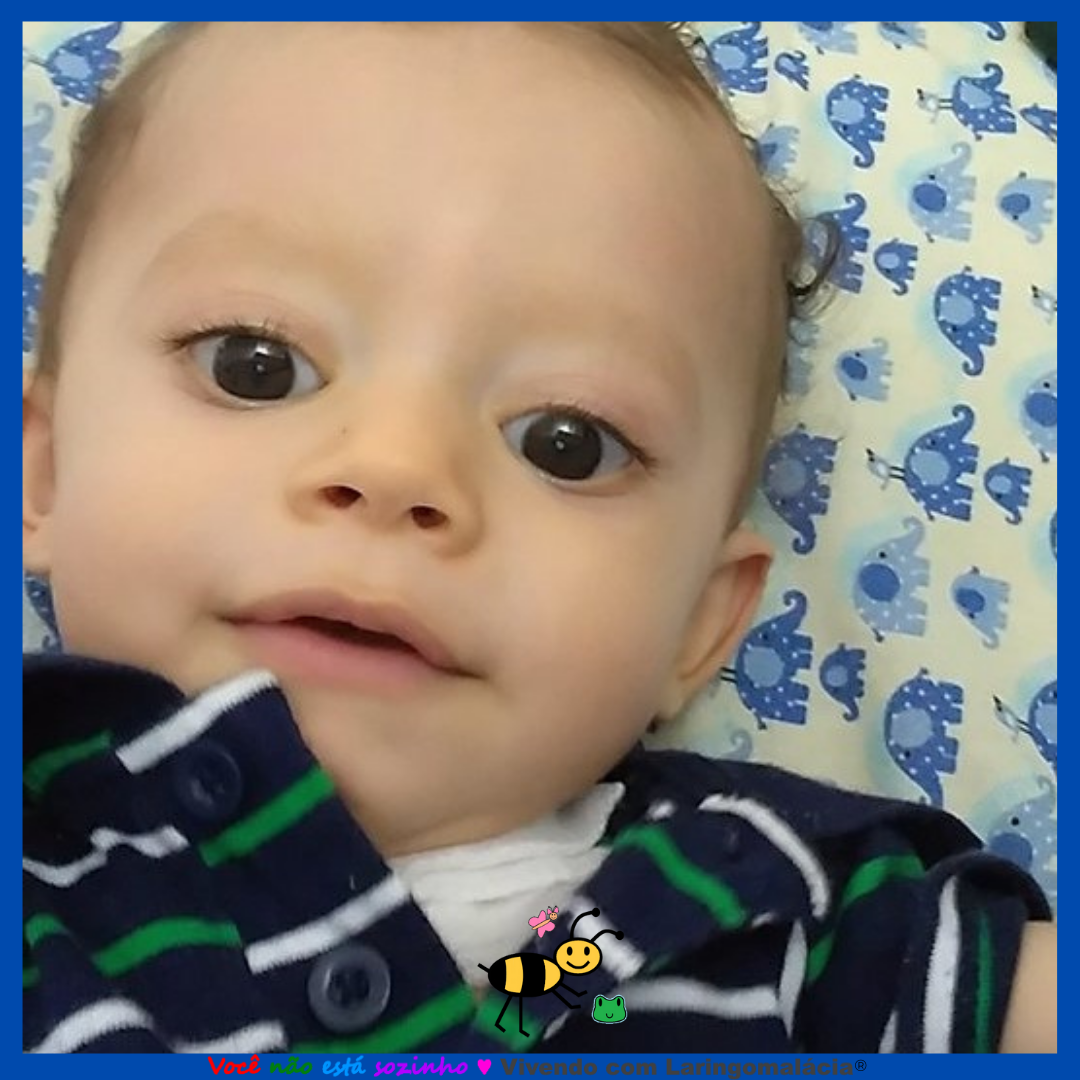 Vivendo com Laringomalácia